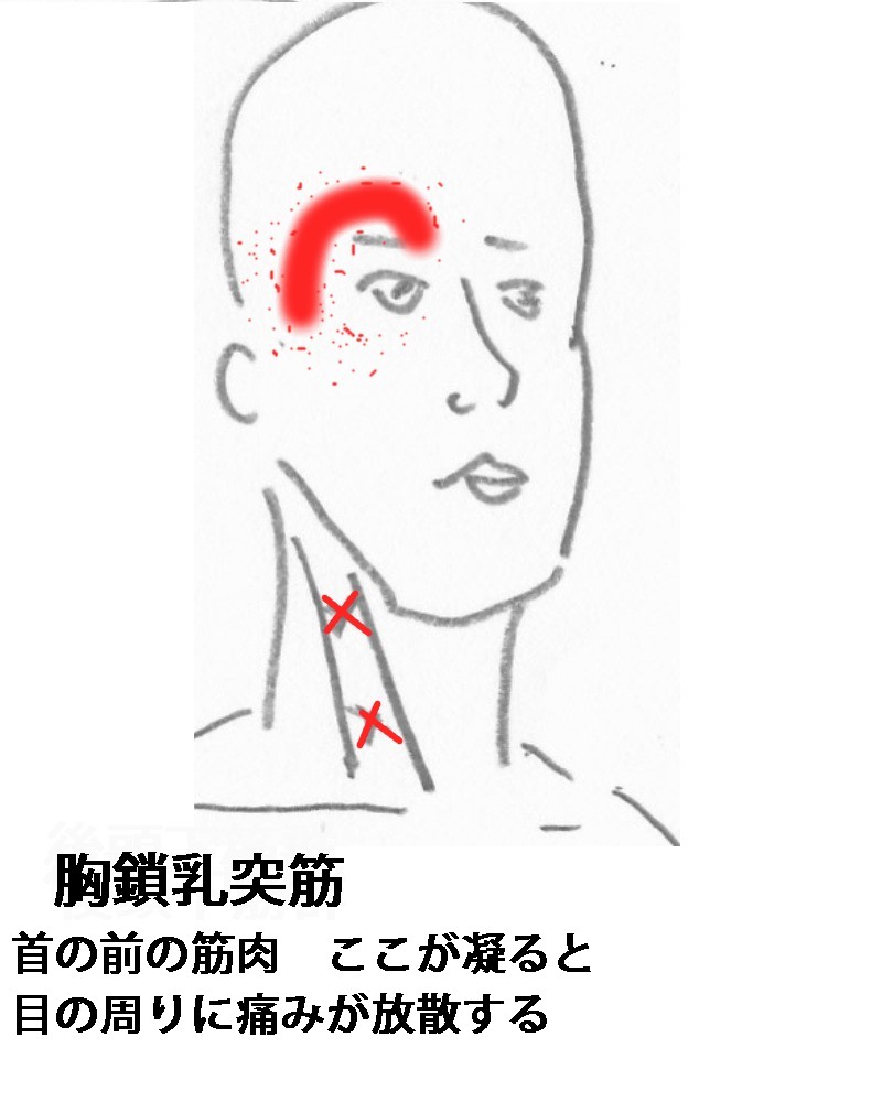 症例報告 右目から後頭部にかけてのず んとした痛み 中央区日本橋 Edo鍼灸治療院