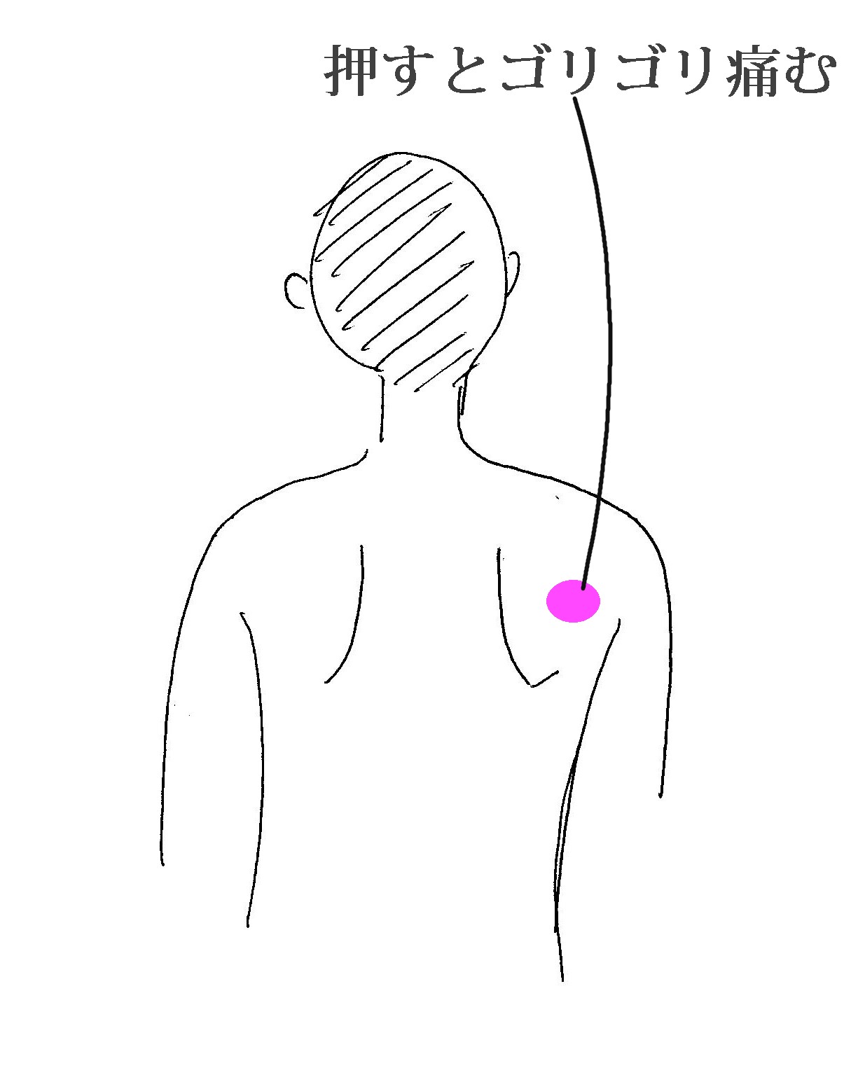 肩甲骨の動きと肩こり 中央区日本橋 Edo鍼灸治療院